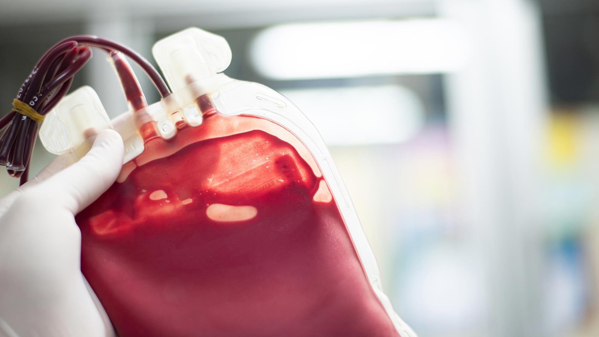 closeup photo of a bag of fresh blood that has been donated